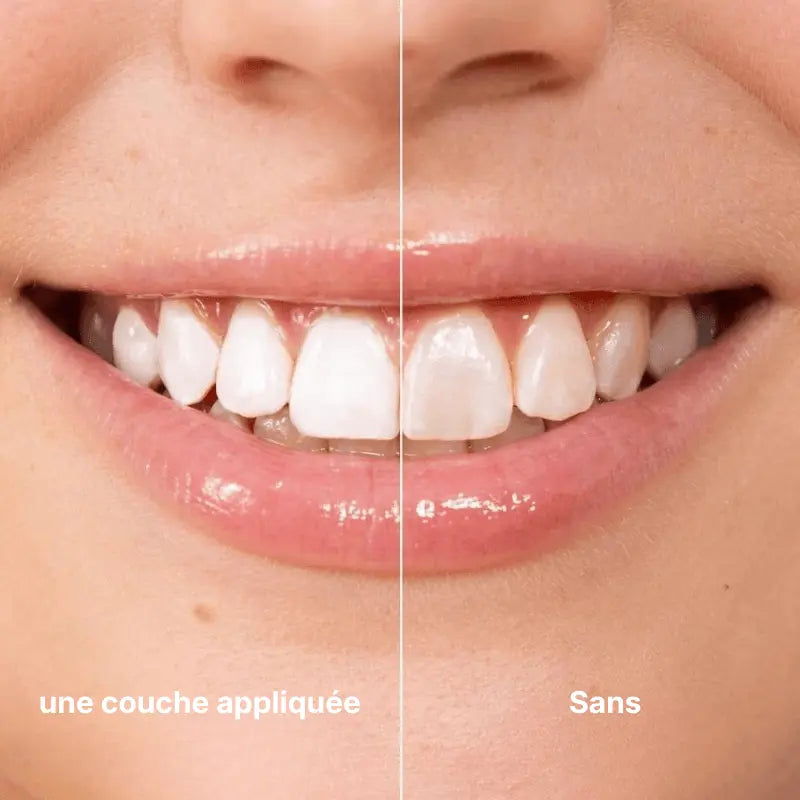 Evlora - sourire éclatant